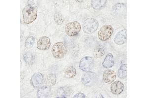 Immunohistochemistry (IHC) image for anti-Histone Deacetylase 7 (HDAC7) (AA 902-952) antibody (ABIN7448594) (HDAC7 anticorps  (AA 902-952))
