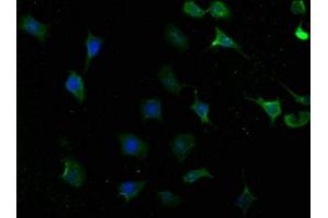 Immunofluorescence staining of SH-SY5Y cells with ABIN7173996 at 1:100, counter-stained with DAPI.