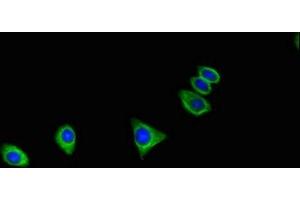 Immunofluorescent analysis of HepG2 cells using ABIN7175033 at dilution of 1:100 and Alexa Fluor 488-congugated AffiniPure Goat Anti-Rabbit IgG(H+L) (C16orf62 anticorps  (AA 6-205))
