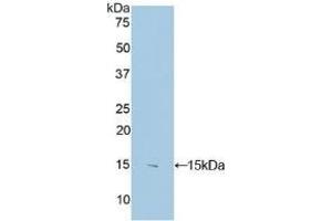 Detection of Recombinant S100B, Human using Polyclonal Antibody to S100 Calcium Binding Protein B (S100B) (S100B anticorps  (AA 1-92))