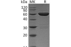 Western Blotting (WB) image for Lectin, Galactoside-Binding, Soluble, 9 (LGALS9) protein (GST tag) (ABIN7320832) (Galectin 9 Protein (GST tag))