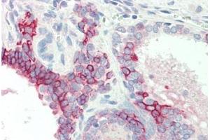 Human, Prostate: Formalin-Fixed Paraffin-Embedded (FFPE)