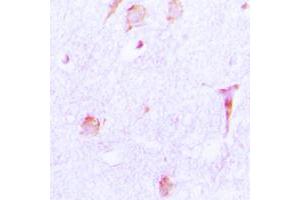 Immunohistochemical analysis of Cathepsin E staining in human brain formalin fixed paraffin embedded tissue section.