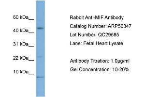 WB Suggested Anti-MIF  Antibody Titration: 0. (MIF anticorps  (Middle Region))