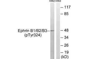 Western blot analysis of extracts from K562 cells treated with serum using Ephrin B1/B2/B3 (Phospho-Tyr324) Antibody. (EFNB1/EFNB2/EFNB3 (pTyr324) anticorps)