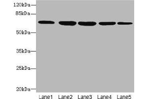 Western blot All lanes: ILVBL antibody at 4 μg/mL Lane 1: HepG2 whole cell lysate Lane 2: Hela whole cell lysate Lane 3: A549 whole cell lysate Lane 4: Jurkat whole cell lysate Lane 5: U87 whole cell lysate Secondary Goat polyclonal to rabbit IgG at 1/10000 dilution Predicted band size: 68 kDa Observed band size: 68 kDa (ILVBL anticorps  (AA 45-344))