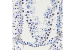 Immunohistochemistry of paraffin-embedded mouse testis using CDKN1B/p27KIP1 antibody (ABIN7266603) at dilution of 1:100 (40x lens).