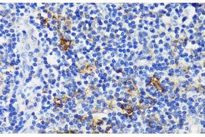 Immunohistochemistry of paraffin-embedded Human tonsil using TREM2 Polyclonal Antibody at dilution of 1:200 (40x lens). (TREM2 anticorps)