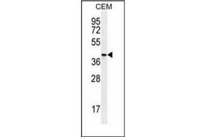 Western blot analysis of OGN Antibody (C-term)  in CEM cell line lysates (35ug/lane). (OGN anticorps  (C-Term))