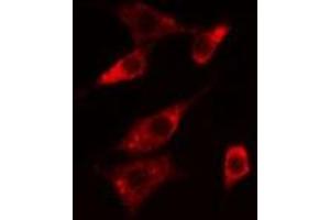 ABIN6276064 staining  Hela cells by IF/ICC. (NTSR1 anticorps  (Internal Region))