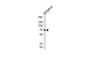 Western blot analysis of lysate from mouse thymus tissue lysate, using Mouse Ephb6 Antibody (Center) (ABIN1881301 and ABIN2838401). (EPH Receptor B6 anticorps  (AA 503-530))