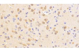 Detection of UCHL1 in Mouse Cerebrum Tissue using Polyclonal Antibody to Ubiquitin Carboxyl Terminal Hydrolase L1 (UCHL1)