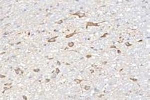 Immunohistochemistry analysis of paraffin-embedded rat cerebellum using,NCKAP1 (ABIN7074784) at dilution of 1: 8000