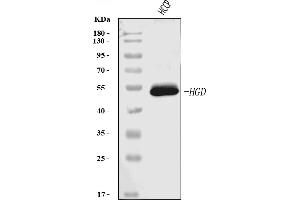 Western blot analysis of HGD using anti-HGD antibody (ABIN7601528).