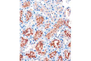 Immunohistochemistry of paraffin-embedded Rat kidney using IQG Rabbit pAb (ABIN7268022) at dilution of 1:100 (40x lens).