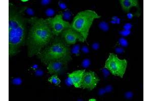 Image no. 3 for anti-Sorting Nexin 9 (SNX9) antibody (ABIN1501045)