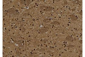 ABIN6278641 at 1/100 staining Rat brain tissue by IHC-P. (T-Box 15/18 anticorps)