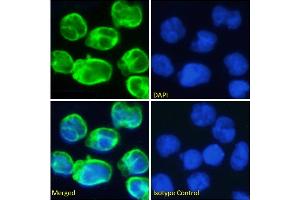Immunofluorescence staining of fixed Molt4 cells with anti-CD3 epsilon antibody OKT-3. (Recombinant CD3E (Muromonab Biosimilar) anticorps)