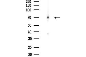 Western blot analysis of lysates from Rat brain, using MUNC-18a Antibody at 1/1000 dilution.