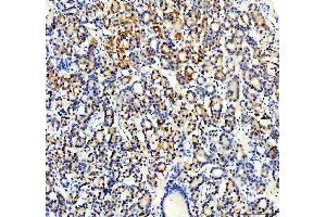 IHC analysis of Synip/STXBP4 using anti-Synip/STXBP4 antibody (ABIN7602066).