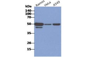 The cell lysates of Ramos, HeLa and A549 (40ug) were resolved by SDS-PAGE, transferred to PVDF membrane and probed with anti-human CD46 antibody (1:1000).