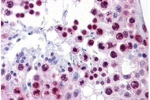 Human Testis: Formalin-Fixed, Paraffin-Embedded (FFPE)