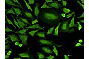 Immunofluorescence of monoclonal antibody to RNF2 on HeLa cell.