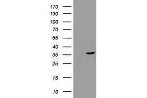 Image no. 1 for anti-Thymidylate Synthetase (TYMS) antibody (ABIN1501597) (TYMS anticorps)