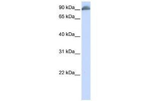 EPB41 antibody used at 1 ug/ml to detect target protein. (EPB41 anticorps  (N-Term))