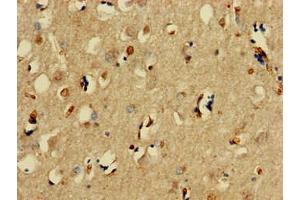 Immunohistochemistry of paraffin-embedded human brain tissue using ABIN7171209 at dilution of 1:100 (SNCAIP anticorps  (AA 309-553))