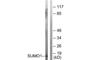 Western Blotting (WB) image for anti-Small Ubiquitin Related Modifier Protein 1 (SUMO1) (N-Term) antibody (ABIN1848853) (SUMO1 anticorps  (N-Term))