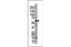 Western blot analysis of anti-P3CC Pab (ABIN392896 and ABIN2837998) in A375cell line lysate.