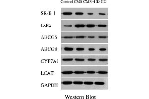 The results of qPCR showed that high fat diet (HD) significantly decreased the expression of LXRα, ABCG5, ABCG8, SR-BI, CYP7A1 and LCAT,and CMS alone significantly elevated the expression of LXRα, ABCG5, ABCG8, and SR-BI, while CMS + HD significantly decreased the expression of ABCG5, ABCG8, CYP7A1 and LCAT.