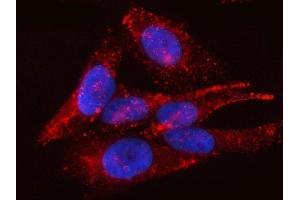 IF analysis of PTRF/CAVIN1 using anti-PTRF/CAVIN1 antibody (ABIN7601817). (PTRF anticorps  (AA 47-390))