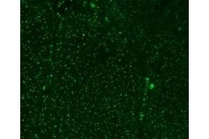 Immunofluorescent testing of colon carcinoma with Alexa Fluor 488 conjugated Nucleoli marker antibody. (Nucleoli Marker anticorps)