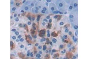 IHC-P analysis of Human Tissue, with DAB staining. (IRF1 anticorps  (AA 11-276))
