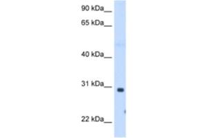 Western Blotting (WB) image for anti-ST3 beta-Galactoside alpha-2,3-Sialyltransferase 3 (ST3GAL3) antibody (ABIN2463000) (ST3GAL3 anticorps)