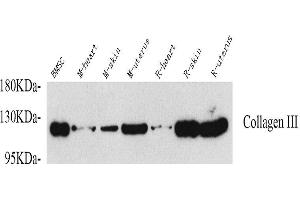 Western Blot analysis of various samples using COL3A1 Polyclonal Antibody at dilution of 1:750. (COL3A1 anticorps)