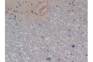 DAB staining on IHC-P; Samples: Rat Spinal cord Tissue (Kallikrein 4 anticorps  (AA 32-256))