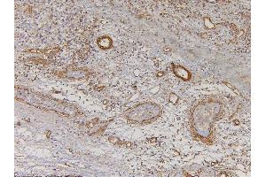 IHC analysis of EHD1 using anti-EHD1 antibody (ABIN6719599). (EHD1 anticorps  (AA 324-516))