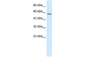 TPH2 antibody used at 1 ug/ml to detect target protein. (Tryptophan Hydroxylase 2 anticorps  (N-Term))