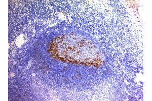Formalin-fixed, paraffin-embedded human Tonsil stained with PD1 (CD279) Monoclonal Antibody (SPM597). (PD-1 anticorps)