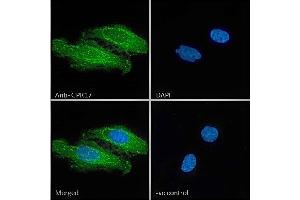 ABIN571066 Immunofluorescence analysis of paraformaldehyde fixed HeLa cells, permeabilized with 0.