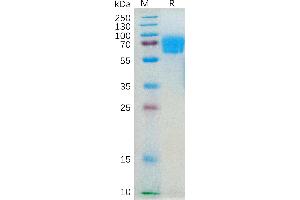 Human IL4RA Protein, mFc Tag on SDS-PAGE under reducing condition.