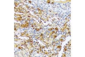 Immunohistochemistry of paraffin-embedded rat ovary using CF antibody (3087) at dilution of 1:100 (40x lens). (A1CF anticorps  (AA 50-120))