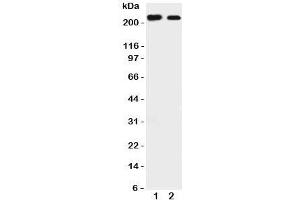 Western blot testing of Tuberin antibody and Lane 1:  rat liver;  2: mouse HEPA cell lysate.