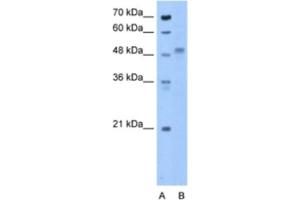 Western Blotting (WB) image for anti-Zona Pellucida Glycoprotein 4 (ZP4) antibody (ABIN2463282) (ZP4 anticorps)