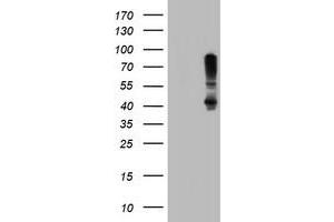 Image no. 1 for anti-serpin Peptidase Inhibitor, Clade B (Ovalbumin), Member 1 (SERPINB1) (AA 77-306) antibody (ABIN1491670)