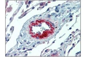Immunohistochemistry (IHC) image for anti-Interleukin 23, alpha subunit p19 (IL23A) antibody (ABIN614363) (IL23A anticorps)