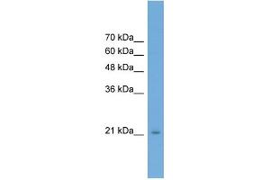 WB Suggested Anti-RAB25 Antibody Titration: 0. (RAB25 anticorps  (Middle Region))